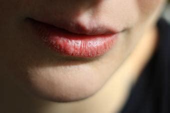 What Causes Swollen Red Painful Lips | Lipstutorial.org