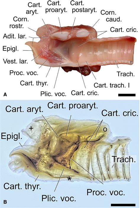 The remarkable vocal anatomy of the koala (Phascolarctos cinereus): insights into low‐frequency ...