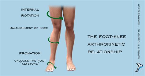 Ankle Internal Rotation