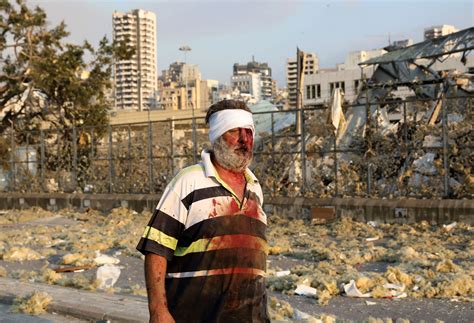 Lebanese hospitals told to prepare for casualties