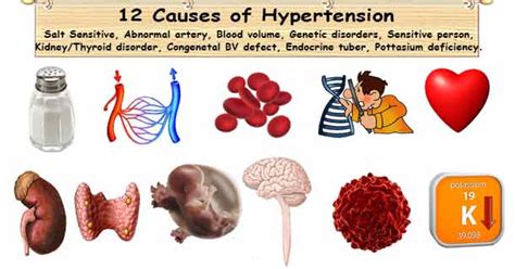 12 Hypertension Causes | 5 Primary & 7 Secondary High Pressure Causes