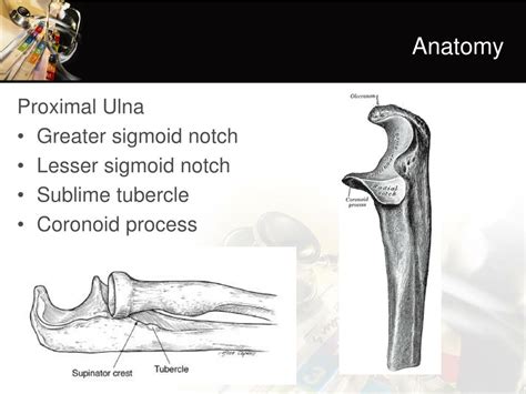 Sigmoid Notch