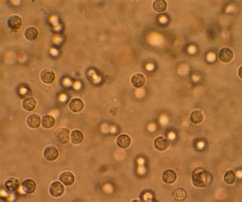 Urine Analysis - Under the Microscope