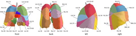 Fig. A1. The overview of pulmonary segment anatomy. There are 18... | Download Scientific Diagram