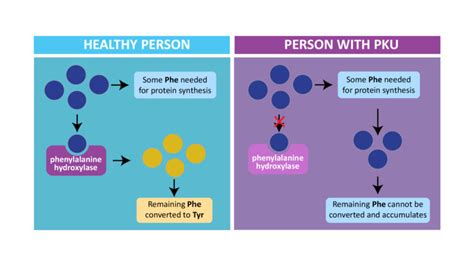 Phenylketonuria (PKU)- Treatment, Prevention, Dietary management – NutritionFact.in