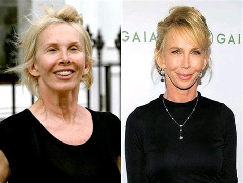 Trudie Styler Plastic Surgery Before After