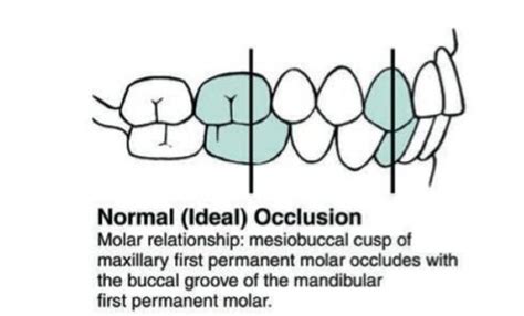 Dental Occlusion Flashcards | Quizlet