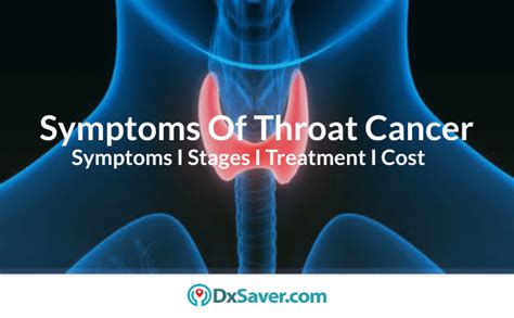 Symptoms of Throat Cancer | More about Early Signs, Causes, Stages & Treatment – DxSaver.com