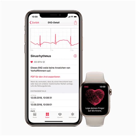 Apple Watch ECG Setup and Use Guide - SimplyMac