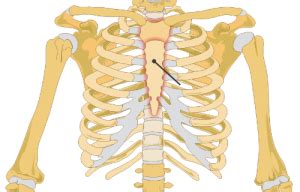 fractured sternum car accident compensation - otegaroegner-99