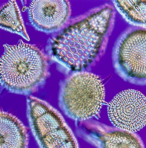 Lm Of An Assortment Of Radiolaria by Pasieka | Shapes images ...