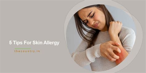 5 Tips For Skin Allergy - The Country