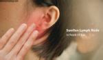 Swollen Lymph Node In Front of Ear - Causes, Treatment, Home Remedies