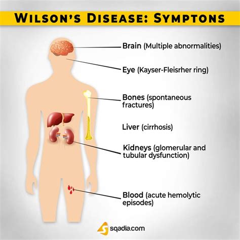 Wilson's Disease | Wilson's disease, Body disorders, Medical videos