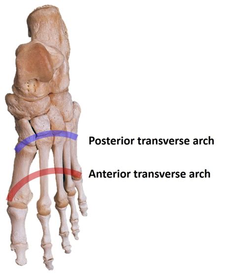 [Figure, Transverse Arches of the Foot Contributed by H Chauhan, MD] - StatPearls - NCBI Bookshelf