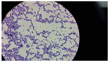 Gram-positive Lactobacillus spp. under the light microscope | Download Scientific Diagram