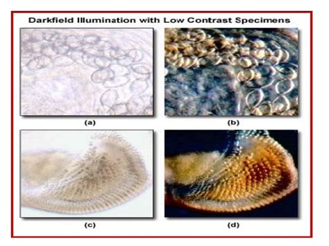 Phase contrast microscopy