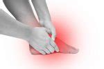 What is Plantar Fibroma and How is it Treated?