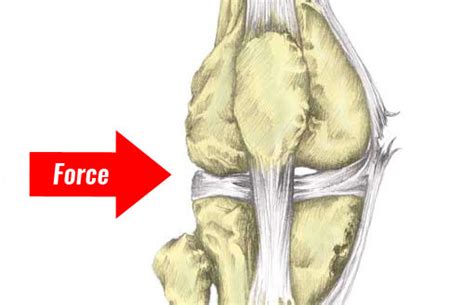 MCL Sprain - Symptoms, Treatment, Exercises & Rehabilitation (2022)