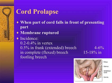 Cord Prolapse