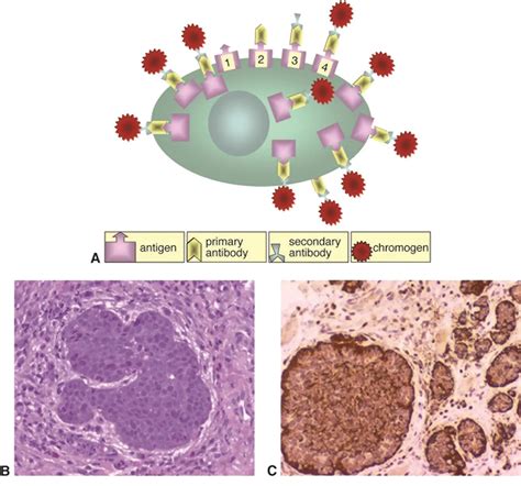 Immunohistochemistry - American Academy of Ophthalmology