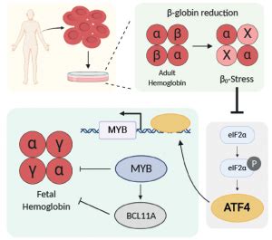 Why does fetal globin increase when editing beta globin? Published in ...