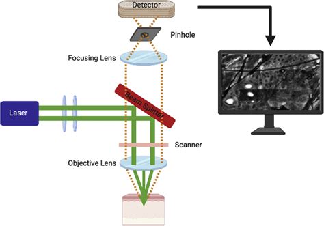 The Benefits Of Confocal Microscopy In Dermatology – EadvVienna2020.org