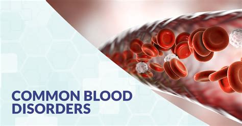 Common Blood Disorders | CFCH | Centre for Clinical Haematology