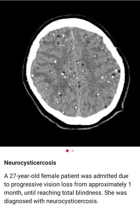 Neurosurgery - MEDizzy