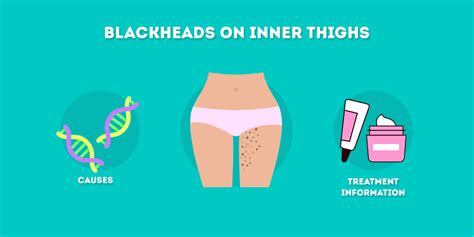 Underarm Blackheads: Causes and Treatments - Skincare Hero