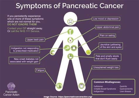 Five Early Warning Signs Of Pancreatic Cancer That Could Save A Life