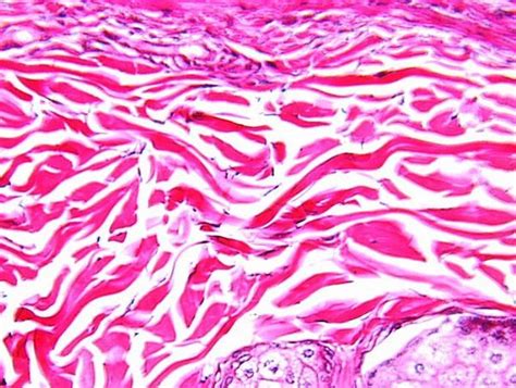 dense irregular connective tissue | Tissue types, Loose connective tissue, Microscopic cells