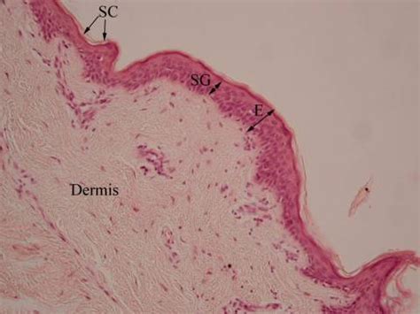 SKIN HISTOLOGY & THE EPIDERMIS: | Muhlenberg College