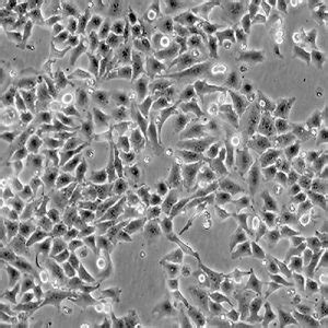 Green Fluorescent HeLa Cell Line - Innoprot Stable Cell Lines