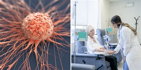 Incredible Breakthrough As Cancer Vanishes For All Patients In Drug Trial