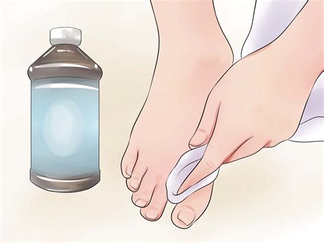 How to Prevent Smelly Feet (with Pictures) - wikiHow