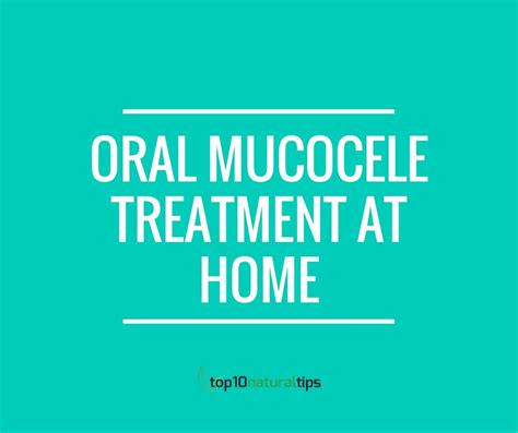 10 effective home remedies to treat mucocele | Top10 Natural Tips