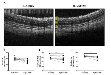 Retinal thickness analysis by SD-OCT at 16 weeks of UPM exposure. (A ...