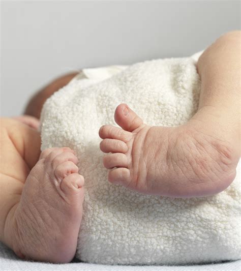 Clubfoot : Club Foot Exercises And Stretches Embracingimbalance Com - Clubfoot is one of the ...