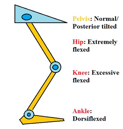 Crouch Gait and Floor Reaction Orthosis