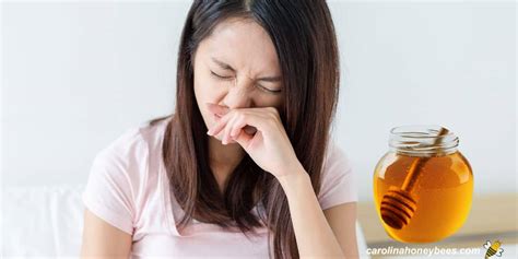 Can You be Allergic to Honey? Understanding Honey Allergies- Carolina ...