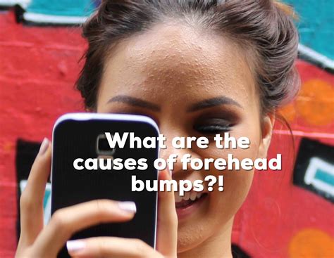 OVERVIEW OF A BUMPY FOREHEAD — Liz Claire