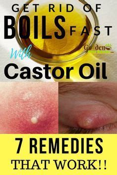 TOP 3 Home REMEDIES for BOILS Under ARMPITS | How to GET RID of a BOIL ...