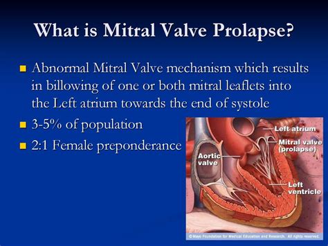 Mitral Valve Prolapse