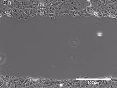 Wound Healing Assay | Migration Assay | Principle | ibidi
