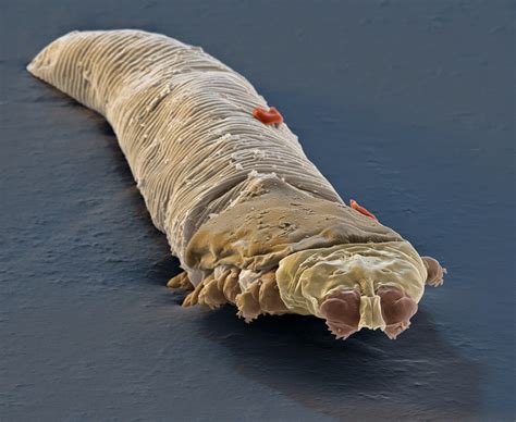 25 Lovely Do Demodex Mites Feed On Coconut Oil - Demodectic Mange