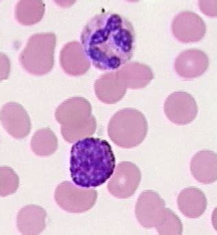 Basophils in Microscopy, Procedure, Staining and Observations