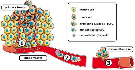 Circulating Tumors Cells in Metastasis | Encyclopedia MDPI