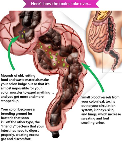 Constipation & Bowel Movement - Functional Health Network Functional ...