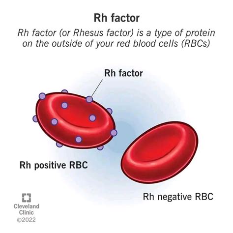 HOW BLOOD GROUP AFFECT A PREGNANT WOMAN BABY.(Rhesus incompatibility ...